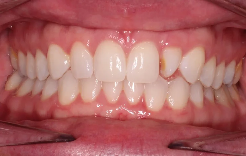Center - Before Treatment
