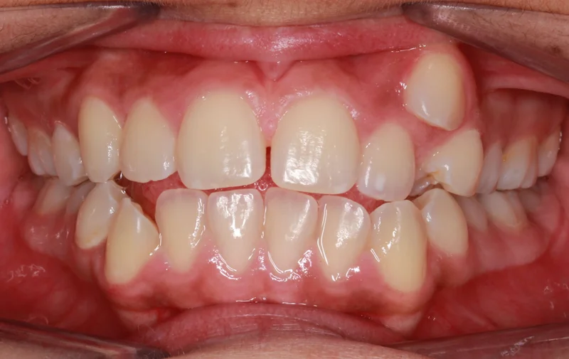 Center - Before Treatment