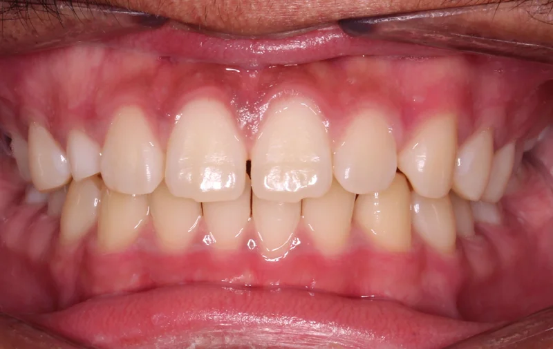 Center - Before Treatment