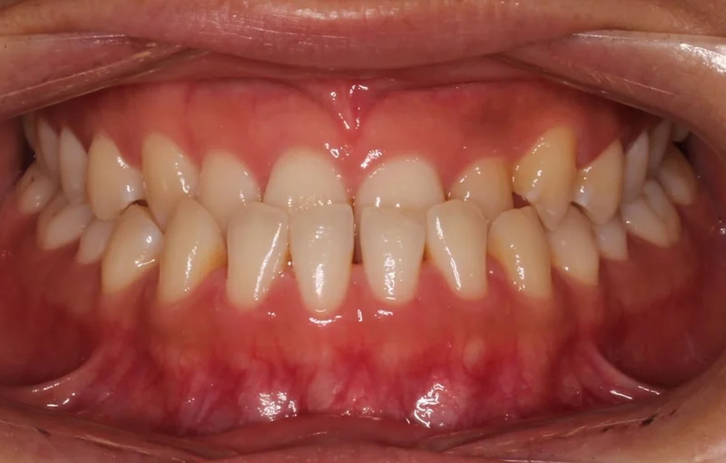 Center - Before Treatment