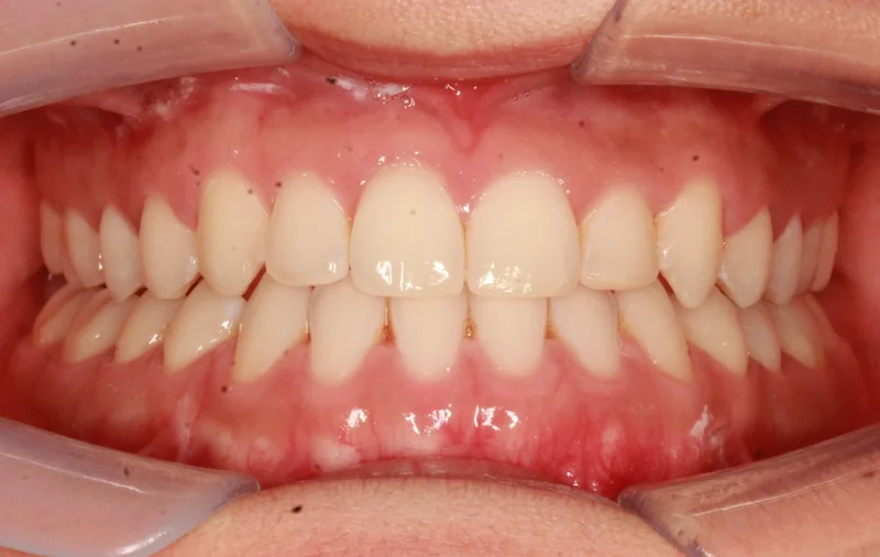 Center - After Treatment