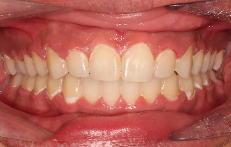 Center - After Treatment