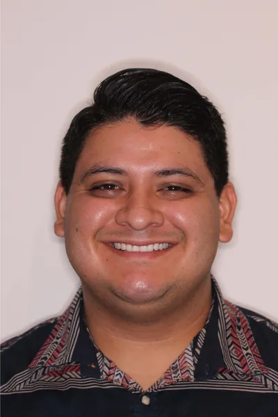 Before Metal Braces treatment - Case 92667
