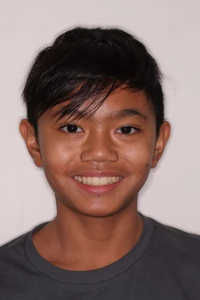 Before Metal Braces treatment - Case 102686