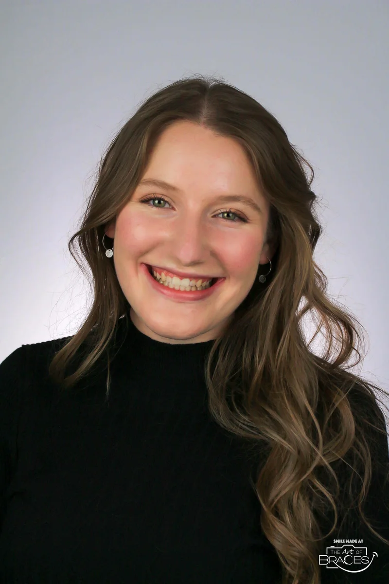 Facial Smiling - After Treatment
