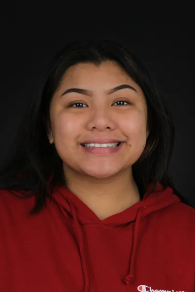 After Metal Braces treatment - Case 59660
