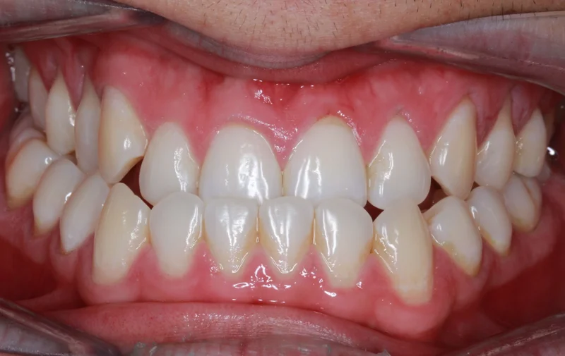 Center - Before Treatment