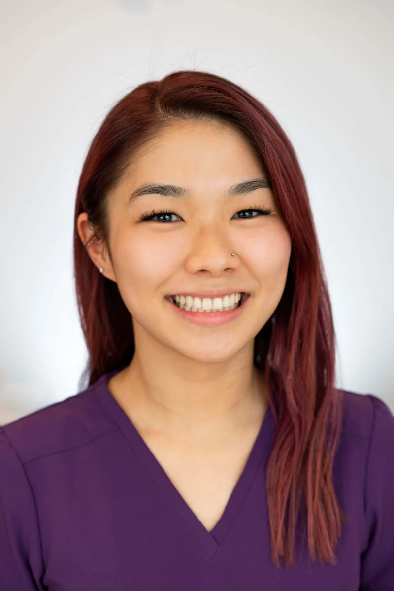 Facial Smiling - After Treatment